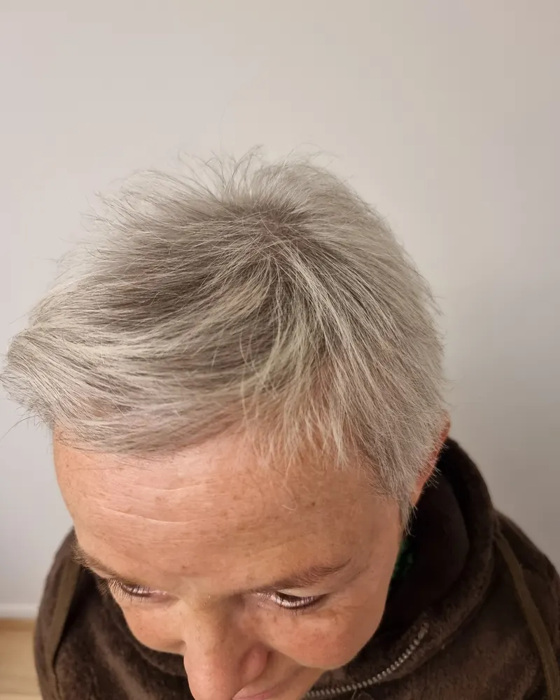 Dezelfde vrouw na de behandeling, met zichtbaar voller grijs haar